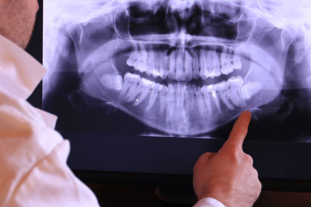 Best Urgent Dental Care in San Antonio, FL