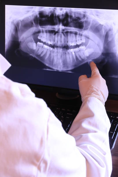 Best Emergency Treatment for Toothache in San Antonio, FL